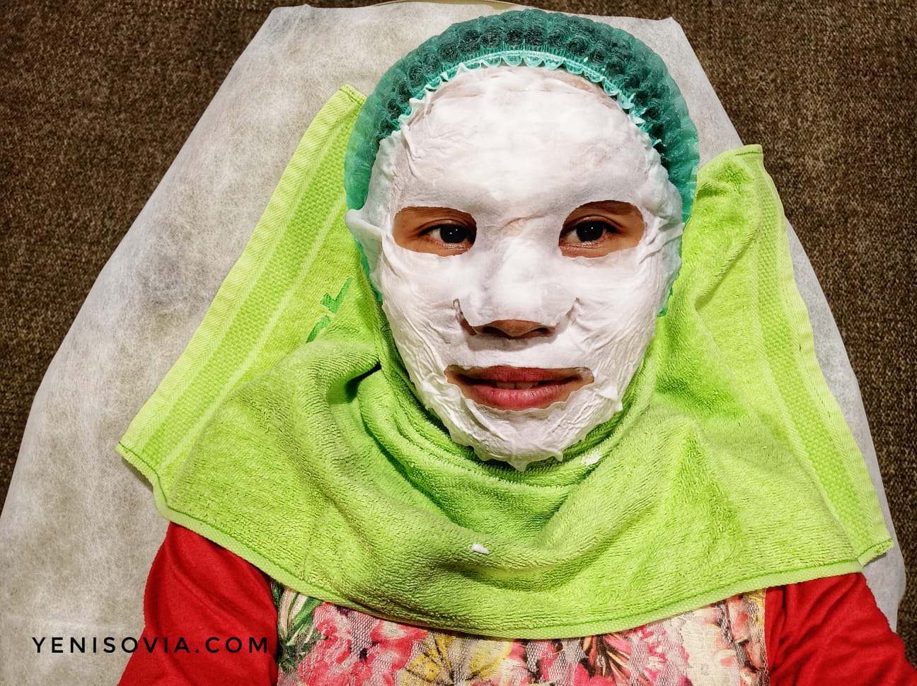 Pengalamanku Face PRP Treatment di ZAP Clinic Treatment di ZAP Clinic